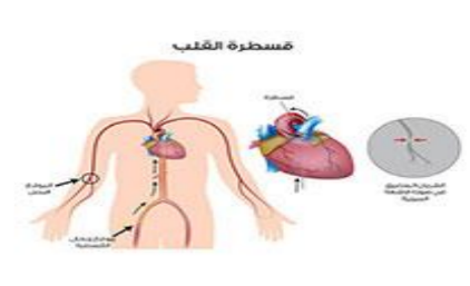 ماذا نقصد بالاختبارات الفيزيولوجية الكهربائية للقلب ؟ Capture14