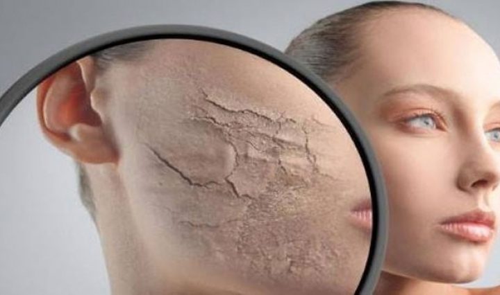 ما هي أسباب جفاف الجلد ؟ ما هي أسباب جفاف الجلد ؟