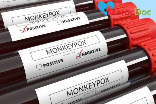 كشف أسرار جدري القرود Monkeypox: فهم الفيروس وإدارته في عالمنا الحديث 2024 تشخيص جدري القرود Variole du singe: كيفية إجراء الفحوصات والتأكيد على المرض
