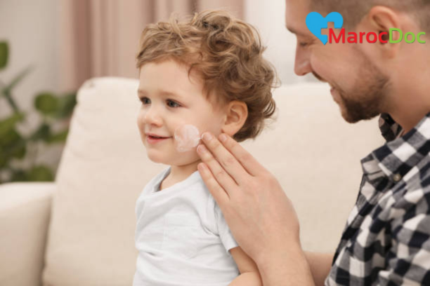 استخدام العلاجات المنزلية للأمراض الجلدية عند الأطفال