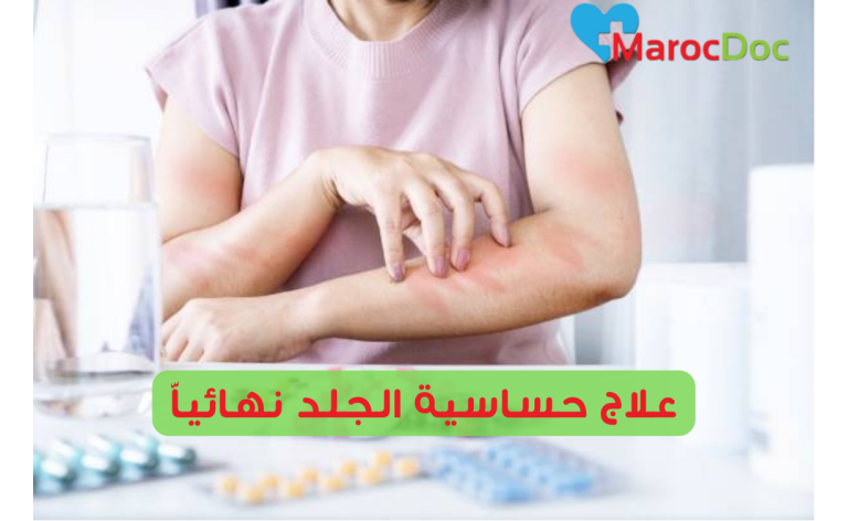  علاج حساسية الجلد نهائياً