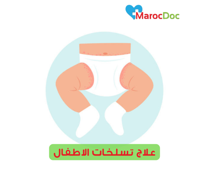 علاج تسلخات الاطفال| 10 طرق لعلاج تسلخات الأطفال الشديدة