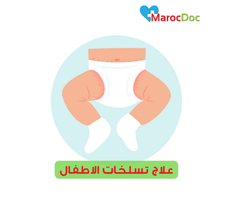 علاج تسلخات الاطفال| 10 طرق لعلاج تسلخات الأطفال الشديدة