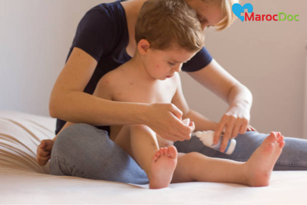 علاج تسلخات الذكر