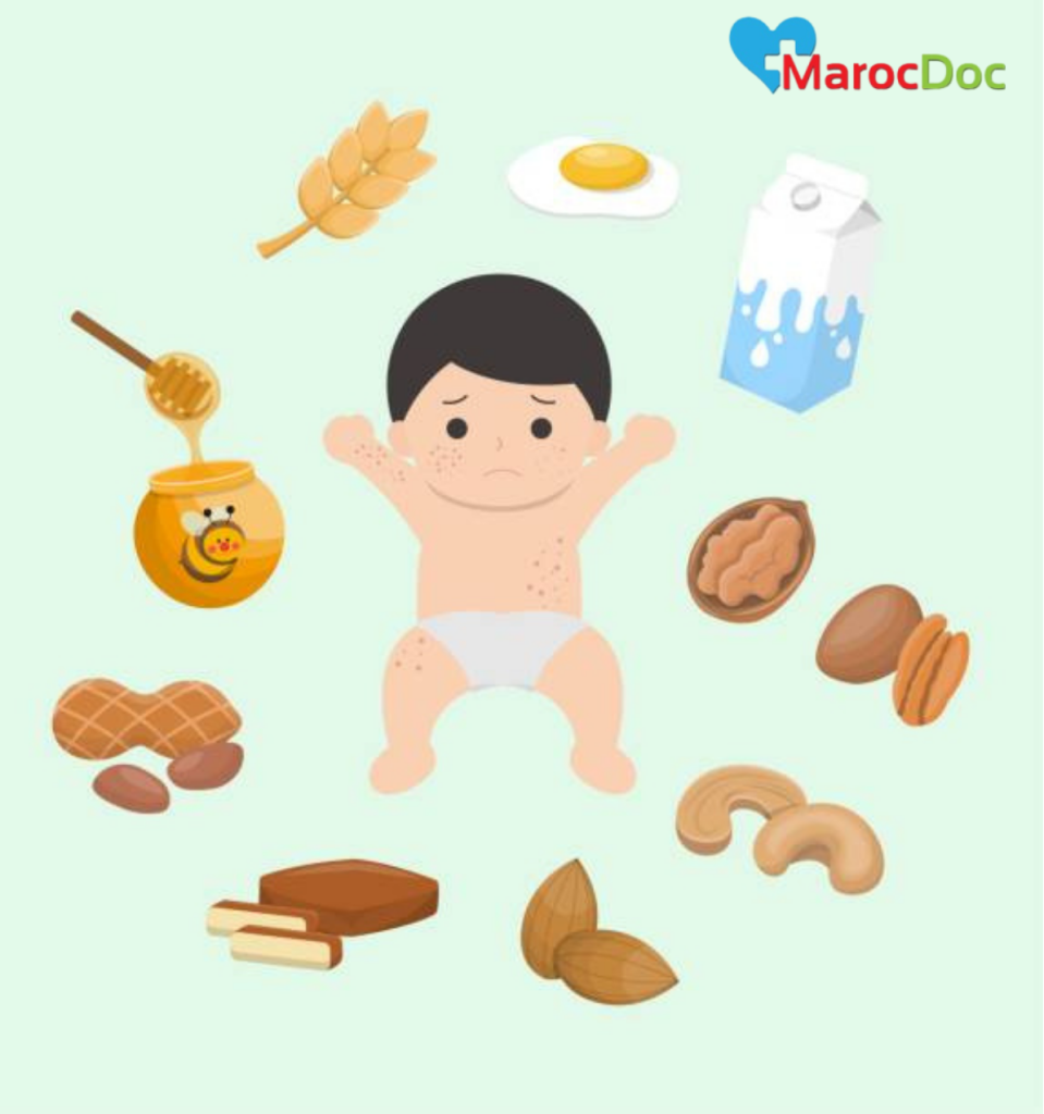 علاج التسلخات بين الفخذين في المنزل
