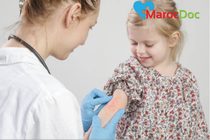 أحدث تطورات العلاج الطبي للإكزيما عند الأطفال