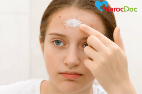 علاج حبوب الوجه الحمراء الملتهبة| 11 طريقة طبية ومنزلية للعلاج طرق علاج حبوب الوجه الحمراء الملتهبة طبيًا