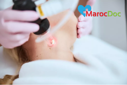 7 خيارات جراحية وغير جراحية لعلاج الزوائد الجلدية هل يمكن أن تظهر الزوائد الجلدية مجددًا بعد العلاج؟
