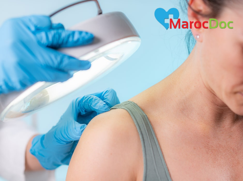 إزالة الكيس الدهني بدون جراحة| 6 عوامل تساعدك في الاختيار الشفط بالليزر (Laser Liposuction)