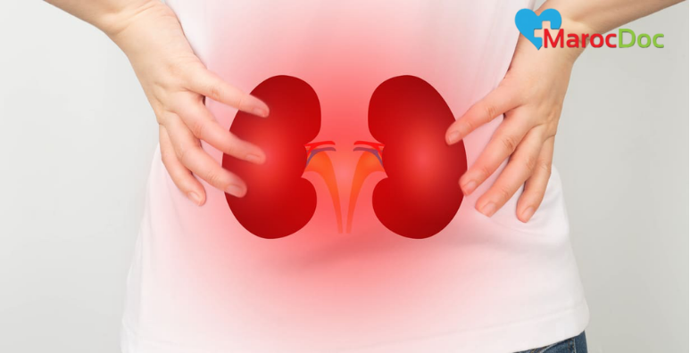 6 علاجات الطبية لحالات الفشل الكلوي العلاجات الطبية لحالات الفشل الكلوي