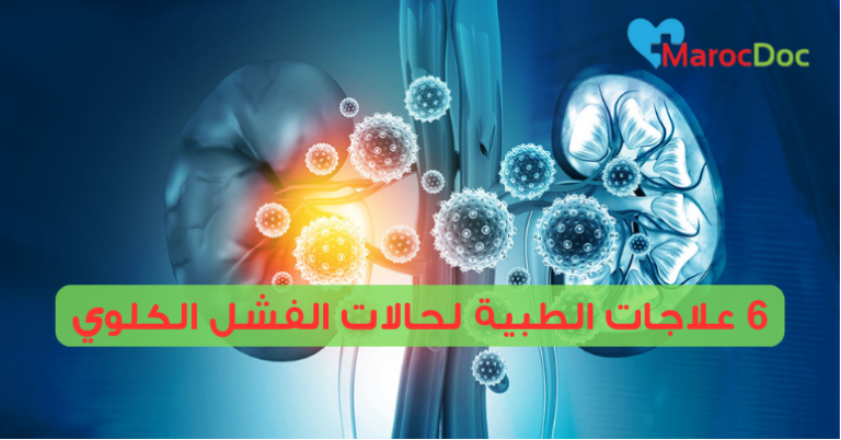 6 علاجات الطبية لحالات الفشل الكلوي