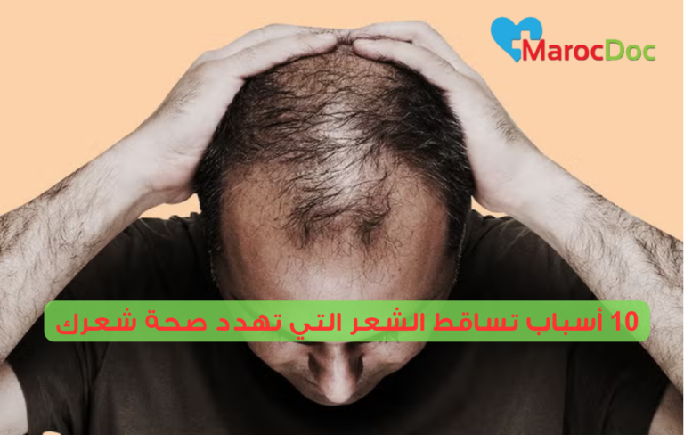 10 أسباب تساقط الشعر التي تهدد صحة شعرك