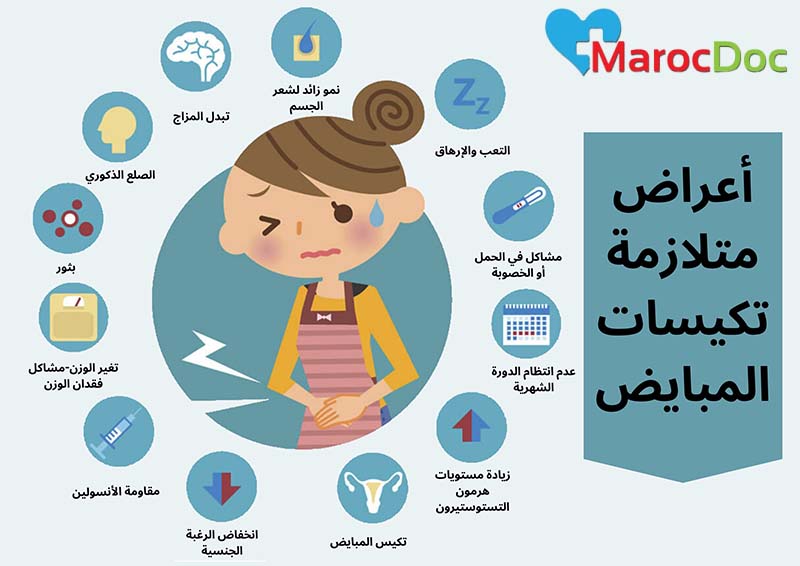 أعراض تكيس المبايض يسبب حب الشباب زيادة الوزن تساقط الشعر