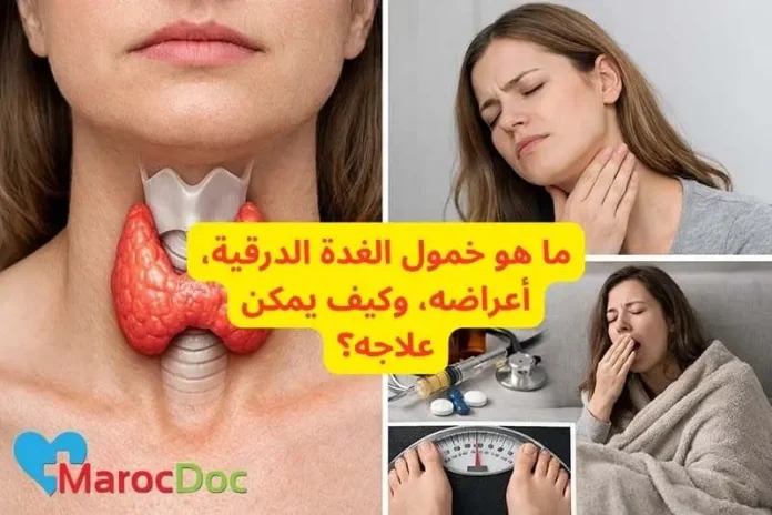 ما هو خمول الغدة الدرقية، أعراضه، وكيف يمكن علاجه؟ ما هو خمول الغدة الدرقية، أعراضه، وكيف يمكن علاجه؟